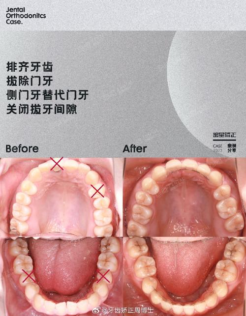 治疗缩小
