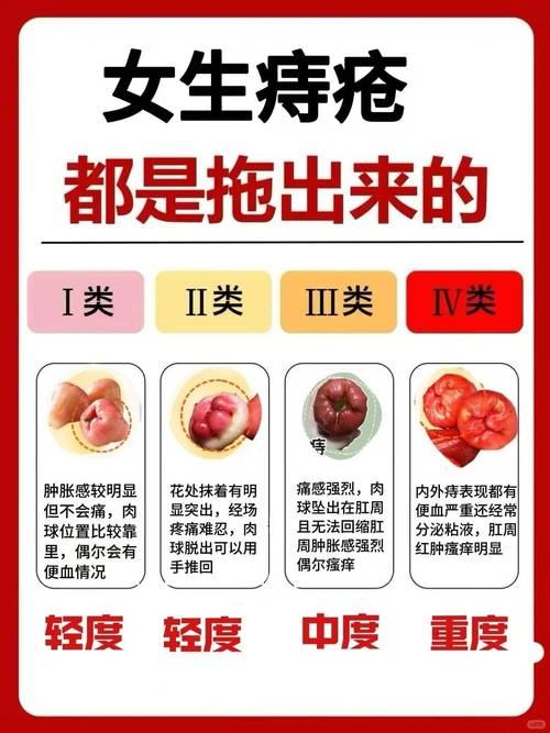 怀孕期间可能会出现痔疮吗？