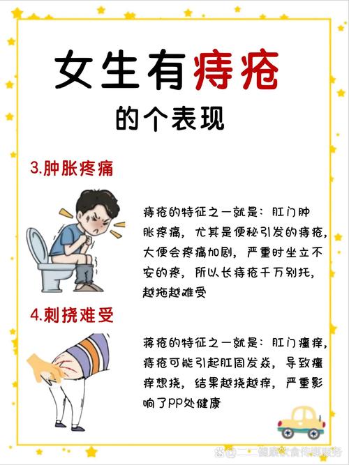 女生如何预防和治疗痔疮？