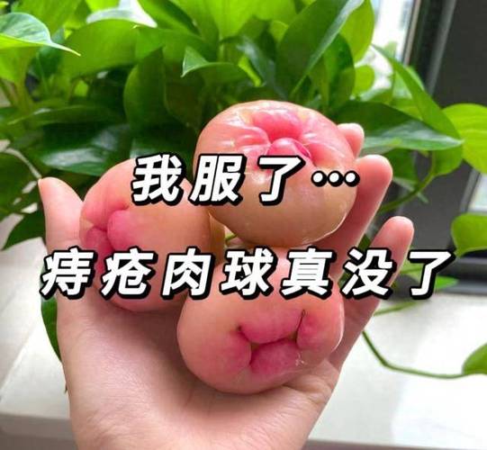 使用花椒塞屁股真的能治愈痔疮吗？