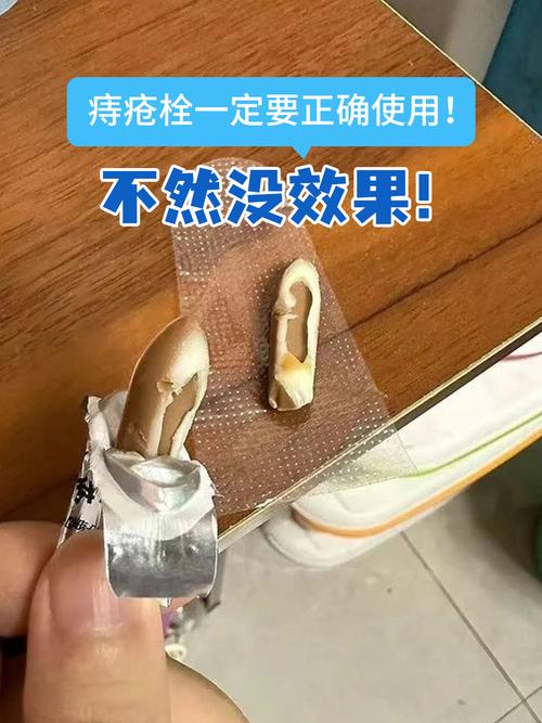 痔疮破溃后能否使用痔疮栓？